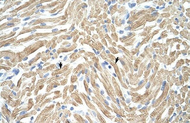 TPM1 Antibody in Immunohistochemistry (Paraffin) (IHC (P))