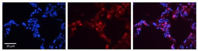 SFTPB Antibody in Immunohistochemistry (Paraffin) (IHC (P))