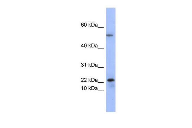 PLA2G5 Antibody in Western Blot (WB)