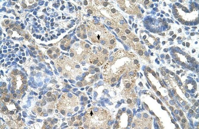 PRPS2 Antibody in Immunohistochemistry (Paraffin) (IHC (P))