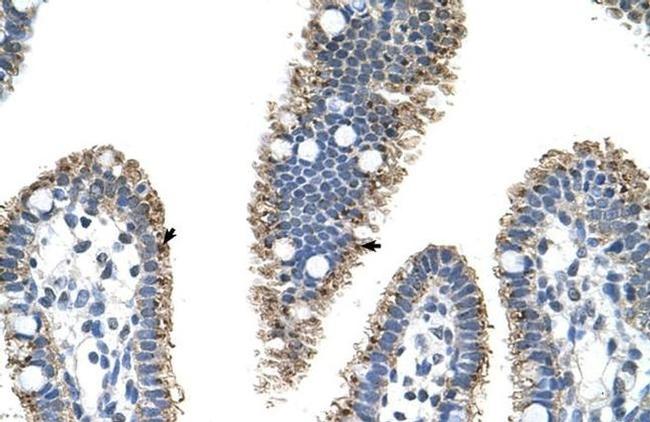 PRODH2 Antibody in Immunohistochemistry (Paraffin) (IHC (P))