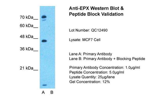 EPX Antibody in Western Blot (WB)