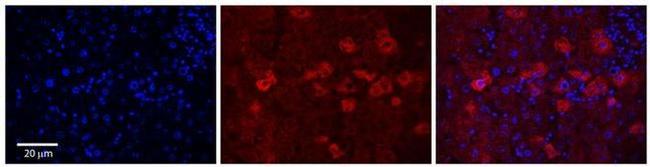 CYP4F3 Antibody in Immunohistochemistry (Paraffin) (IHC (P))