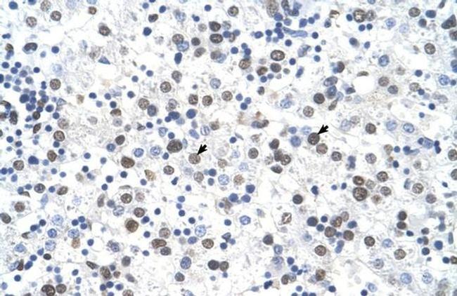 FECH Antibody in Immunohistochemistry (Paraffin) (IHC (P))