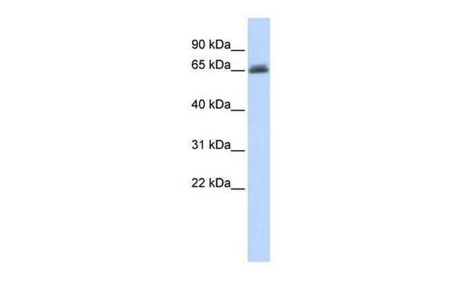 UGT2B15 Antibody in Western Blot (WB)