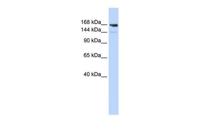 Periplakin Antibody in Western Blot (WB)