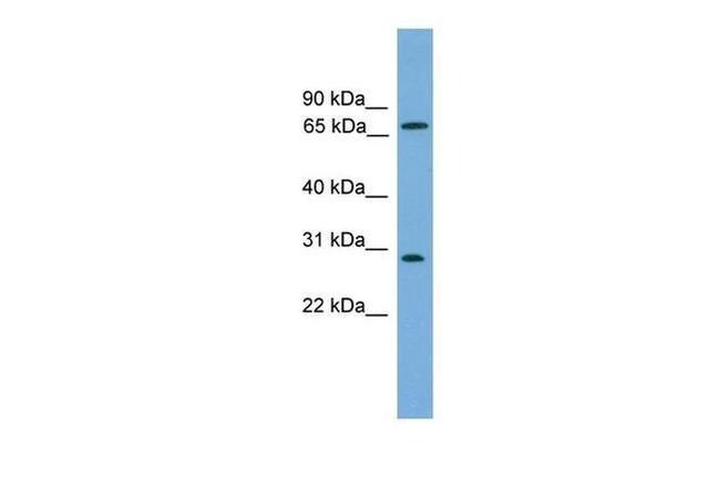 SEMG2 Antibody in Western Blot (WB)