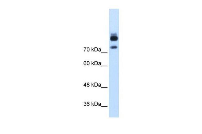 MTMR1 Antibody in Western Blot (WB)