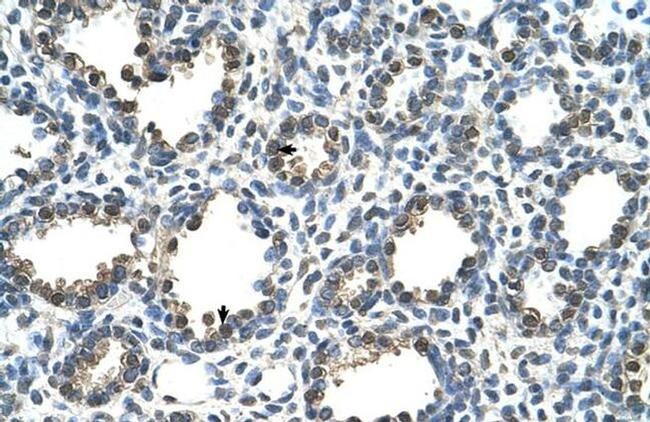 RAD23A Antibody in Immunohistochemistry (Paraffin) (IHC (P))