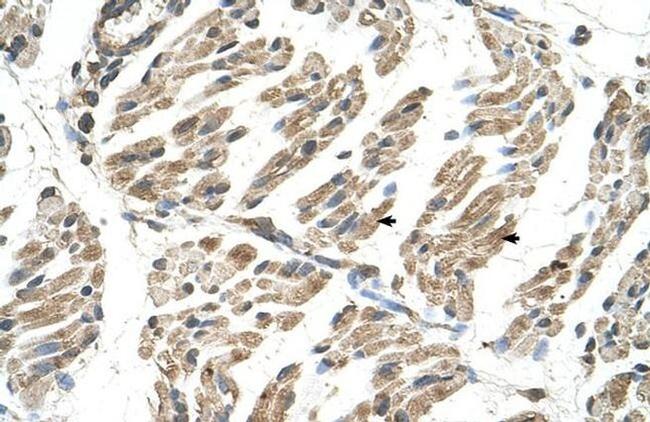 SLC6A8 Antibody in Immunohistochemistry (Paraffin) (IHC (P))