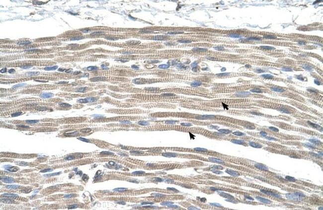 GPR161 Antibody in Immunohistochemistry (Paraffin) (IHC (P))