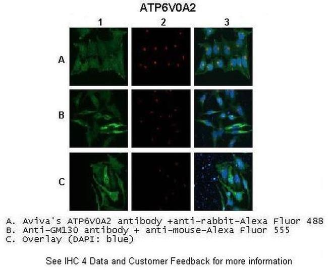 ATP6V0A2 Antibody in Immunocytochemistry (ICC/IF)