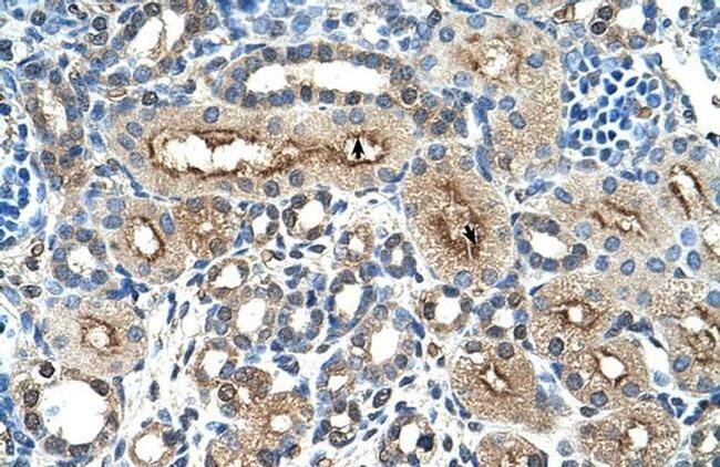 CD299 (DC-SIGN/L) Antibody in Immunohistochemistry (IHC)