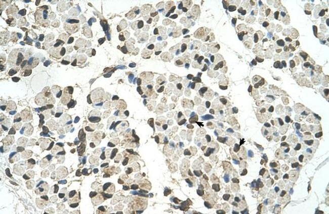 PSD3 Antibody in Immunohistochemistry (IHC)