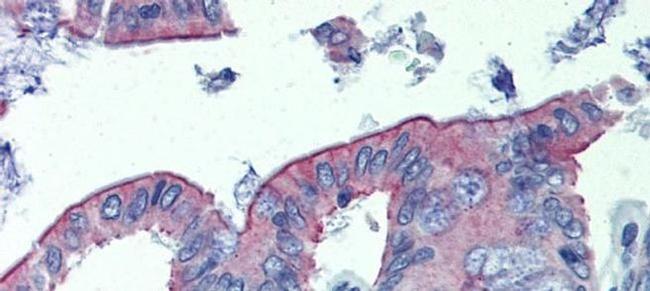 CGI58 Antibody in Immunohistochemistry (IHC)