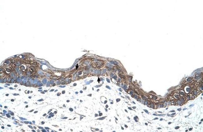 Ankyrin 1 Antibody in Immunohistochemistry (IHC)