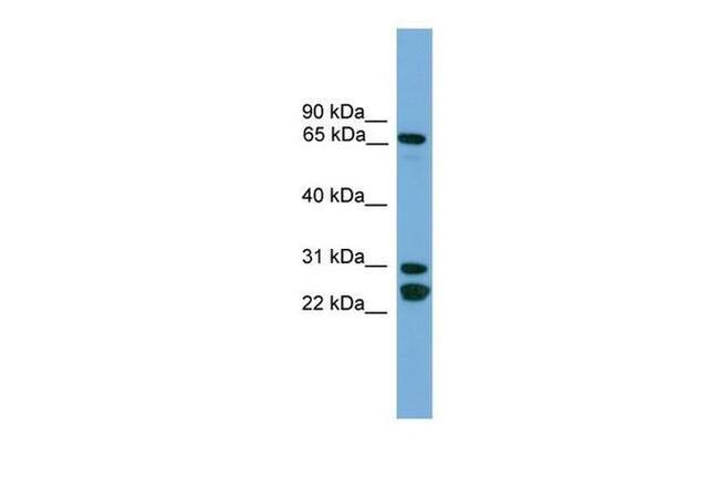 DNAI2 Antibody in Western Blot (WB)