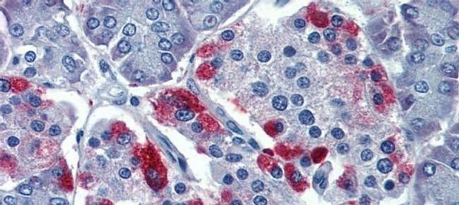 GNAS Antibody in Immunohistochemistry (Paraffin) (IHC (P))