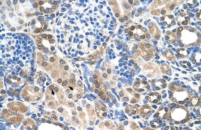 SLC22A7 Antibody in Immunohistochemistry (IHC)