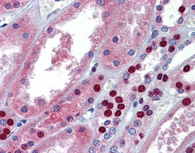 MUPP1 Antibody in Immunohistochemistry (IHC)