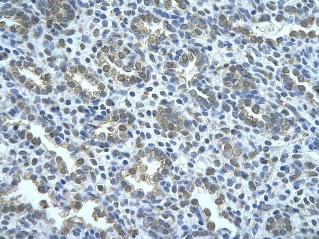 AIP2 Antibody in Immunohistochemistry (Paraffin) (IHC (P))