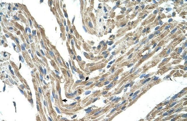 FBXL5 Antibody in Immunohistochemistry (IHC)