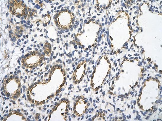 UBE2J1 Antibody in Immunohistochemistry (Paraffin) (IHC (P))