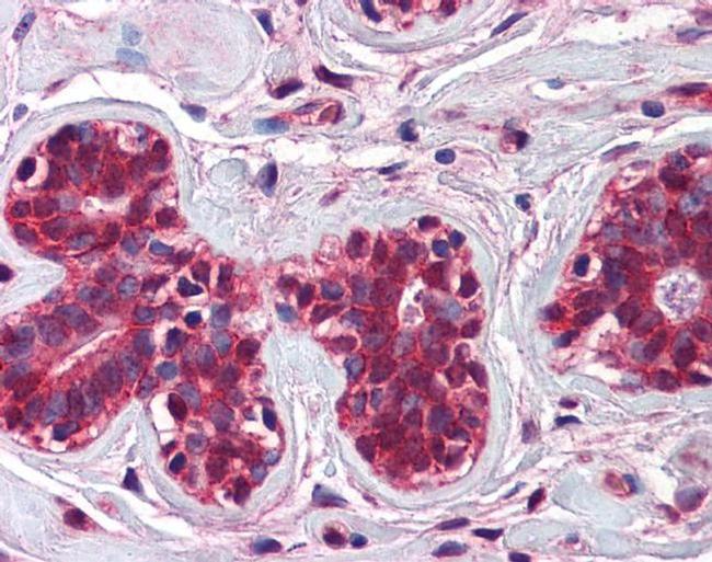 CHFR Antibody in Immunohistochemistry (IHC)