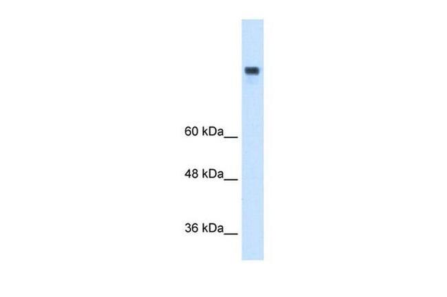 MTTP Antibody in Western Blot (WB)