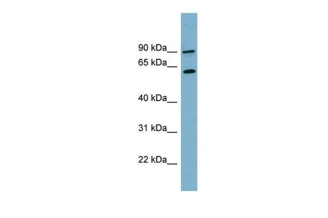 SLC3A1 Antibody in Western Blot (WB)