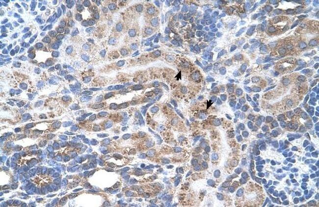 ENT2 Antibody in Immunohistochemistry (IHC)