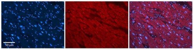 SLC25A12 Antibody in Immunohistochemistry (Paraffin) (IHC (P))