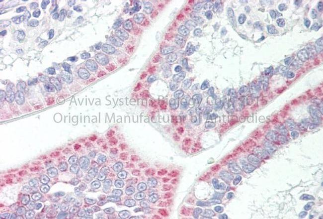 SLC33A1 Antibody in Immunohistochemistry (Paraffin) (IHC (P))