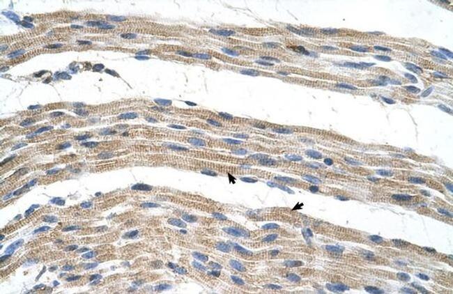 SLC17A4 Antibody in Immunohistochemistry (IHC)