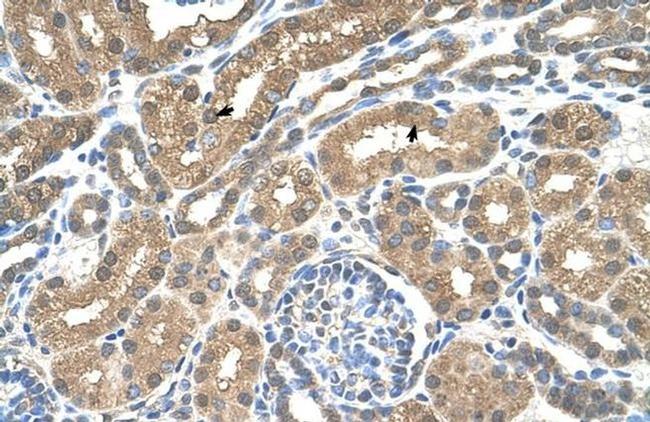 SLC16A8 Antibody in Immunohistochemistry (IHC)