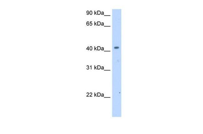 SLC25A24 Antibody in Western Blot (WB)