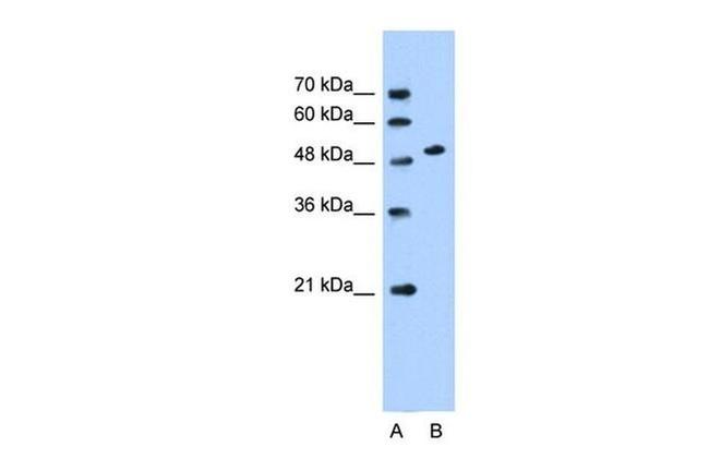 SLC30A1 Antibody in Western Blot (WB)