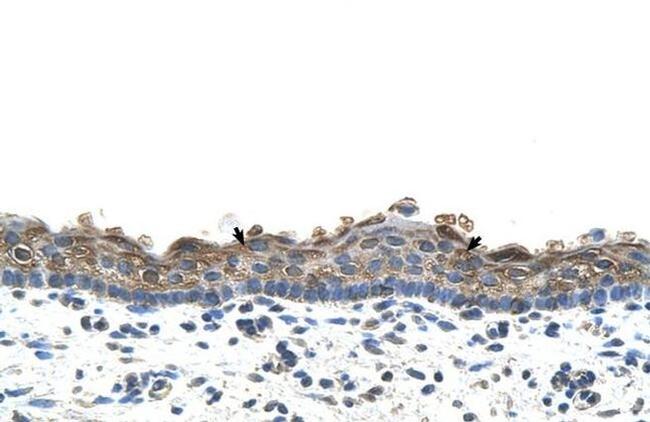 SLC26A1 Antibody in Immunohistochemistry (IHC)