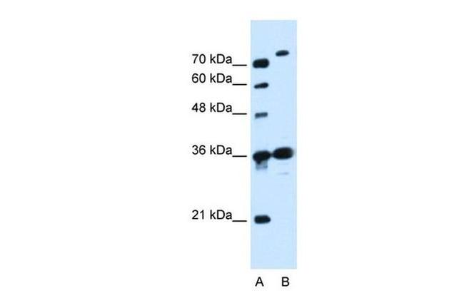 SLC9A7 Antibody in Western Blot (WB)