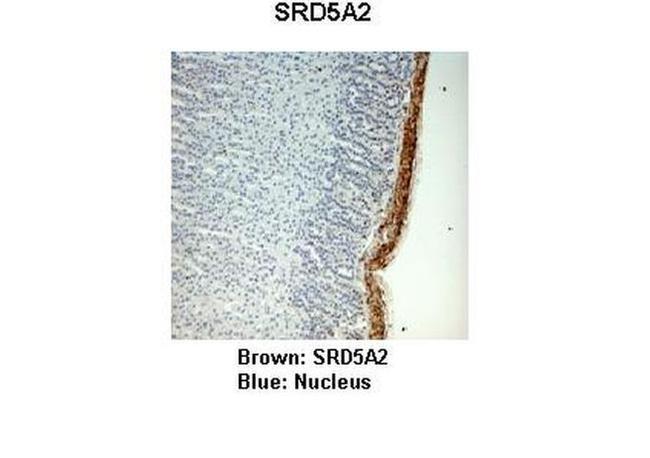 SRD5A2 Antibody in Immunohistochemistry (IHC)