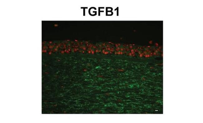 TGFBI Antibody in Immunohistochemistry (IHC)