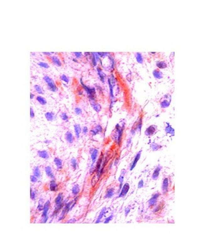 M-CSF Antibody in Immunohistochemistry (IHC)