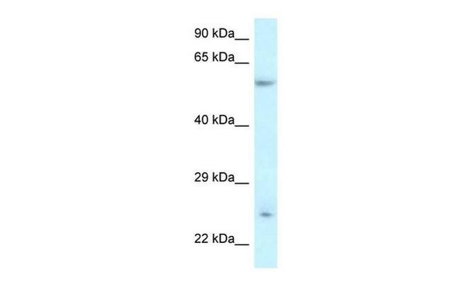 DERL3 Antibody in Western Blot (WB)