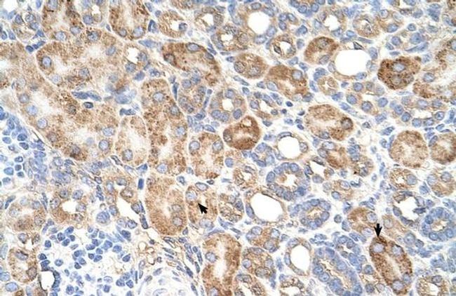 ALG11 Antibody in Immunohistochemistry (IHC)