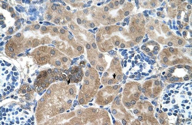 Syntenin 1 Antibody in Immunohistochemistry (IHC)