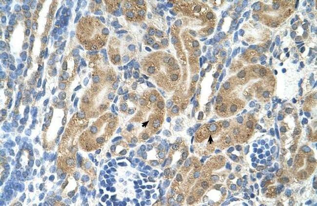 PARL Antibody in Immunohistochemistry (Paraffin) (IHC (P))