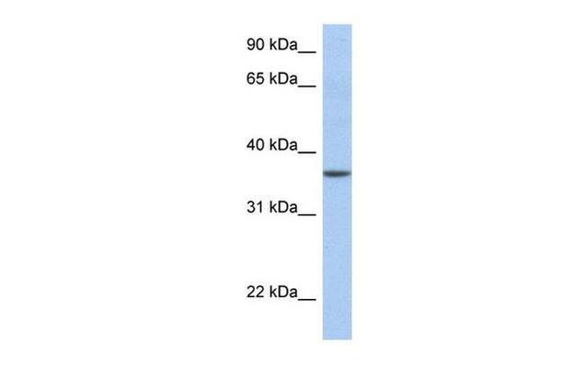 LFNG Antibody in Western Blot (WB)