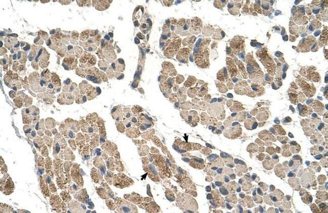 CLCC1 Antibody in Immunohistochemistry (IHC)