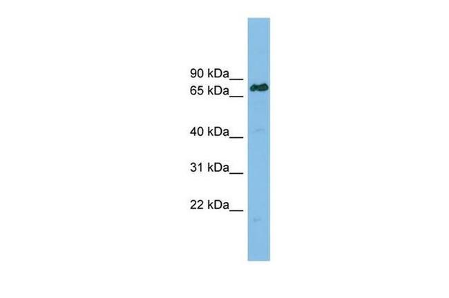 Lamin B Receptor Antibody in Western Blot (WB)