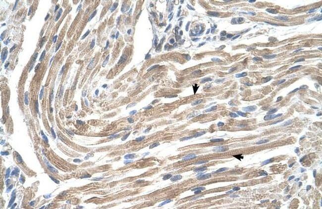 MGST2 Antibody in Immunohistochemistry (IHC)